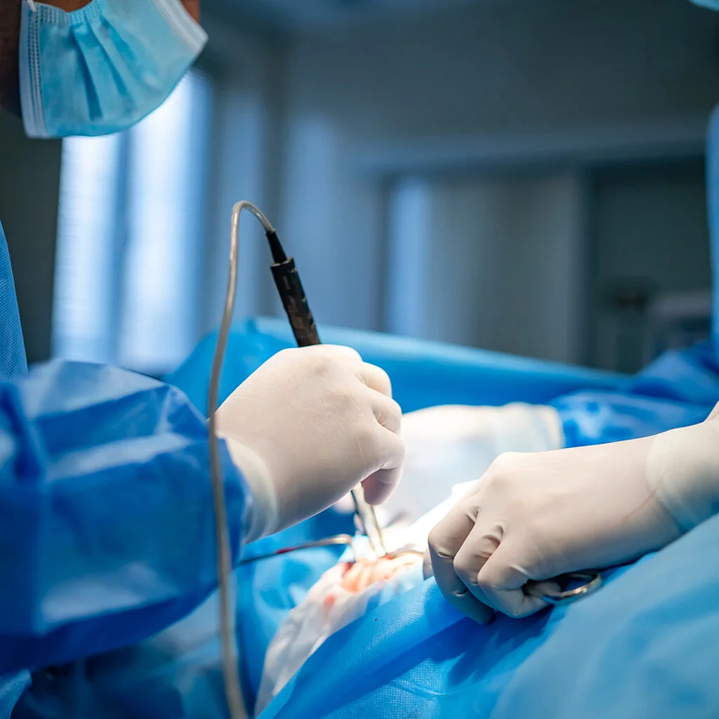 Picture of an operation on a patient with one doctor holding a medical instrument and one holding a suction instrument.