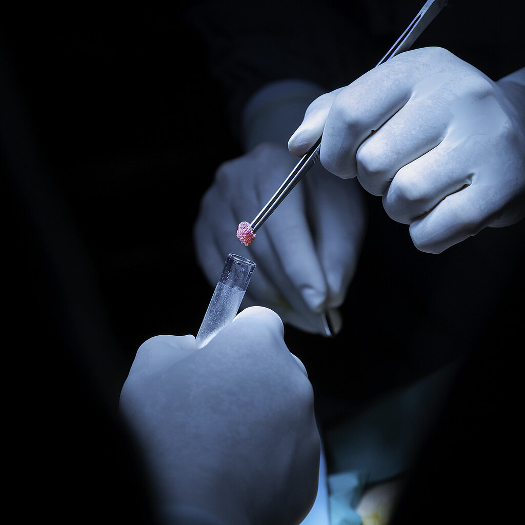Doctor wearing blue gloves placing a biopsy sample from a needle into a tube for testing.